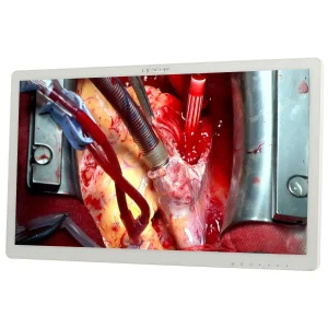 MONITOR QUIRÚRGICO FOIL HD 27”